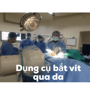 Bắt vít qua da